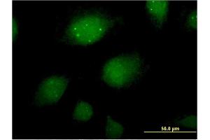 Immunofluorescence of monoclonal antibody to ING2 on HeLa cell. (ING2 anticorps  (AA 1-280))
