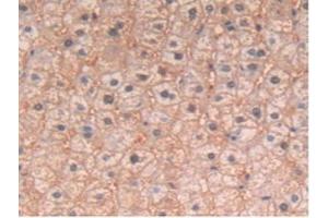 Detection of IL4 in Human Liver Tissue using Polyclonal Antibody to Interleukin 4 (IL4) (IL-4 anticorps  (AA 25-153))