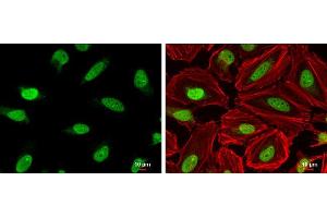 ICC/IF Image DNA ligase III antibody [C2C3], C-term detects DNA ligase III protein at nucleus by immunofluorescent analysis.