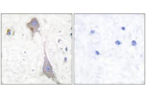Immunohistochemical analysis of paraffin-embedded human brain tissue using GluR7 antibody (ABIN5976414).