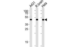 Western Blotting (WB) image for anti-DEAD (Asp-Glu-Ala-Asp) Box Polypeptide 39 (DDX39) antibody (ABIN3003892) (BAT1 anticorps)