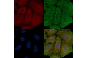 ABIN6259023 and ABIN6273879 staining Hela cells(30 min of UV treatment) by IF/ICC. (LGR4 anticorps  (C-Term))