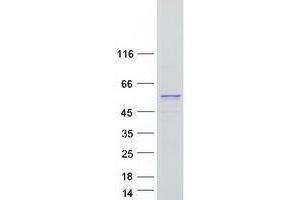 Validation with Western Blot