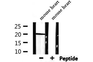 Western blot analysis of extracts from mouse heart, using ARF1 Antibody. (ARF1 anticorps  (Internal Region))