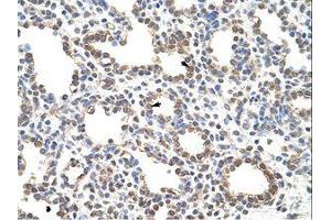 anti-Zinc Finger Protein 195 (ZNF195) (N-Term) antibody