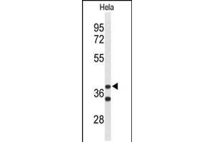 Western blot analysis of CYTH3 Antibody in Hela cell line lysates (35ug/lane). (Cytohesin 3 anticorps  (C-Term))