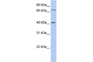 WB Suggested Anti-GALNT4 Antibody Titration:  0. (GALNT4 anticorps  (C-Term))