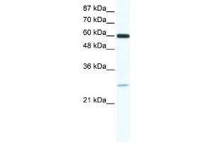 WB Suggested Anti-ZFP91 Antibody   Titration: 0. (ZFP91 anticorps  (N-Term))