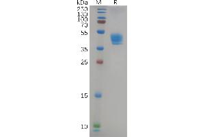 Human Protein, hFc Tag on SDS-PAGE under reducing condition.