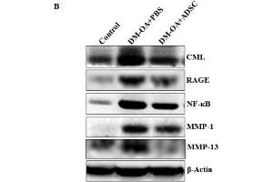 Effect of ADSC administration on expression of AGE-RAGE axis mediated activation of catabolic signalling pathways.