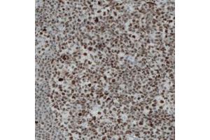 Immunohistochemical staining (Formalin-fixed paraffin-embedded sections) of human tonsil with REST monoclonal antibody, clone CL0381  shows strong nuclear immunoreactivity in the lymphoid cells. (REST anticorps)