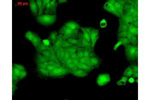 Immunocytochemistry/Immunofluorescence analysis using Rabbit Anti-ERK1 Polyclonal Antibody (ABIN361832 and ABIN361833).