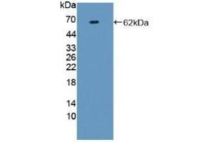 Detection of Recombinant F1+2, Human using Polyclonal Antibody to Prothrombin Fragment 1+2 (F1+2) (Prothrombin Fragment 1+2 anticorps)