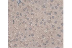 DAB staining on IHC-P; Samples:Mouse Liver Tissue (C5A anticorps  (AA 679-755))