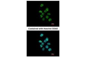 ICC/IF Image Immunofluorescence analysis of paraformaldehyde-fixed A431, using PUF60, antibody at 1:500 dilution. (PUF60 anticorps  (C-Term))