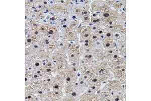 Immunohistochemistry of paraffin-embedded human liver injury using EIF4G2 antibody.