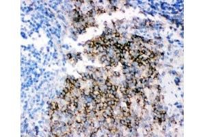 IHC-P staining of rat spleen tissue (CD79b anticorps  (AA 29-229))