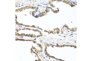 Immunohistochemistry of paraffin-embedded human prostate using OGFR antibody at dilution of 1:100 (x40 lens). (OGFR anticorps)
