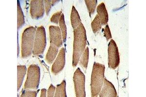 IHC analysis of FFPE human skeletal muscle with WNT5B antibody