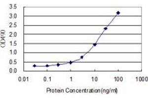 CNTF (Human) Matched Antibody Pair