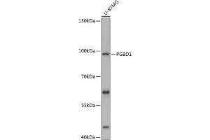 Western blot analysis of extracts of U-87MG cells, using PGBD1 antibody (ABIN7269372) at 1:1000 dilution. (PGBD1 anticorps  (AA 150-450))