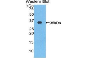 Western Blotting (WB) image for anti-ATP Binding Cassette Transporter A3 (ABCA3) (AA 1358-1635) antibody (ABIN1857856) (ABCA3 anticorps  (AA 1358-1635))