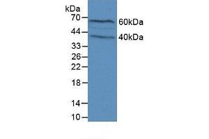 Detection of FLG in Mouse Brain Tissue using Polyclonal Antibody to Filaggrin (FLG) (Filaggrin anticorps  (AA 119-336))