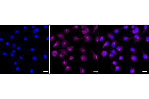 anti-RhoA,B,C antibody