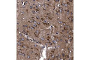 IHC analysis of KLHL12 using anti-KLHL12 antibody (ABIN7601009).