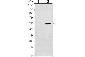 Western blot analysis using SUZ12 mAb against HEK293 (1) and SUZ12(AA: 533-739)-hIgGFc transfected HEK293 (2) cell lysate. (SUZ12 anticorps)