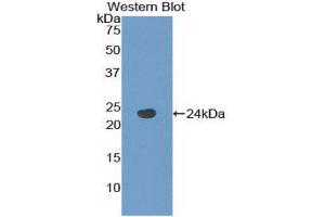 Western Blotting (WB) image for anti-Tachykinin Receptor 2 (TACR2) (AA 92-290) antibody (ABIN1860673) (TACR2 anticorps  (AA 92-290))