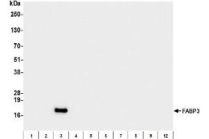 Western Blotting (WB) image for anti-Fatty Acid Binding Protein 3, Muscle and Heart (FABP3) antibody (ABIN7795612) (FABP3 anticorps)