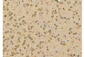 BTF3L3 Antibody at 1/100 staining rat brain tissue by IHC-P. (BTF3P13 anticorps)