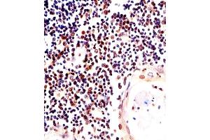 Immunohistochemical analysis of paraffin-embedded H. (H2AFX anticorps  (C-Term))