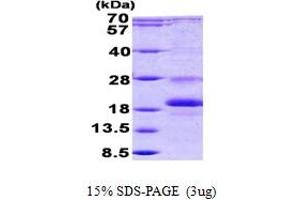SDS-PAGE (SDS) image for Inhibitor of DNA Binding 1, Dominant Negative Helix-Loop-Helix Protein (ID1) (AA 1-155) protein (His tag) (ABIN7280218) (ID1 Protein (AA 1-155) (His tag))