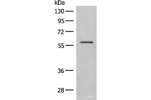 Western blot analysis of Mouse eye tissue lysate using SLC5A1 Polyclonal Antibody at dilution of 1:500 (SLC5A1 anticorps)