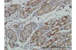 Immunoperoxidase of monoclonal antibody to RPS6KA6 on formalin-fixed paraffin-embedded human stomach.