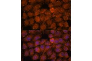 Immunofluorescence analysis of HeLa cells using NDUF antibody (ABIN7268807) at dilution of 1:100. (NDUFAF4 anticorps  (AA 1-170))