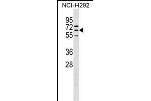 ZN Antibody (N-term) (ABIN1539295 and ABIN2849920) western blot analysis in NCI- cell line lysates (35 μg/lane). (ZNF599 anticorps  (N-Term))