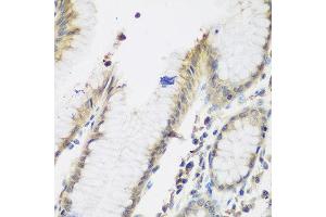Immunohistochemistry of paraffin-embedded human stomach using NAA50 antibody at dilution of 1:200 (40x lens).