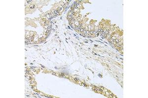 Immunohistochemistry of paraffin-embedded human prostate using BCR antibody (ABIN6003491) at dilution of 1/100 (40x lens).