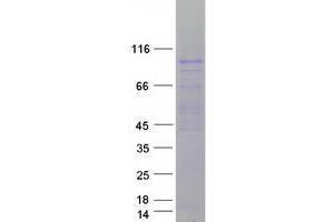Validation with Western Blot