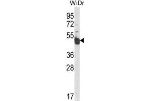 Western Blotting (WB) image for anti-Inscuteable Homolog (INSC) antibody (ABIN3004284) (INSC anticorps)