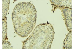 ABIN6274741 at 1/100 staining Mouse testis tissue by IHC-P. (MRPL41 anticorps  (C-Term))