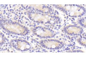 Detection of TFR in Porcine Small intestine Tissue using Polyclonal Antibody to Transferrin Receptor (TFR) (Transferrin Receptor anticorps  (AA 578-765))