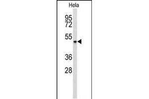 Western blot analysis of ADH6 Antibody (Center) (ABIN653151 and ABIN2842721) in Hela cell line lysates (35 μg/lane). (ADH6 anticorps  (AA 209-240))