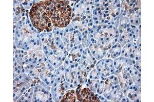 Immunohistochemical staining of paraffin-embedded liver tissue using anti-HSP90AA1mouse monoclonal antibody. (HSP90AA1 anticorps)