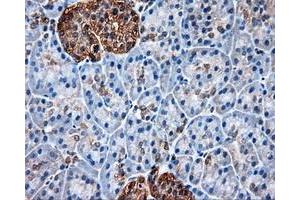 Immunohistochemical staining of paraffin-embedded liver tissue using anti-HSP90AA1mouse monoclonal antibody.
