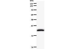 Western Blotting (WB) image for anti-Excision Repair Cross-Complementing Rodent Repair Deficiency, Complementation Group 8 (ERCC8) antibody (ABIN931164) (ERCC8 anticorps)