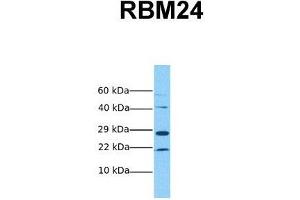 Host:  Rabbit  Target Name:  RBM24  Sample Tissue:  Human MCF7  Antibody Dilution:  1. (RBM24 anticorps  (Middle Region))